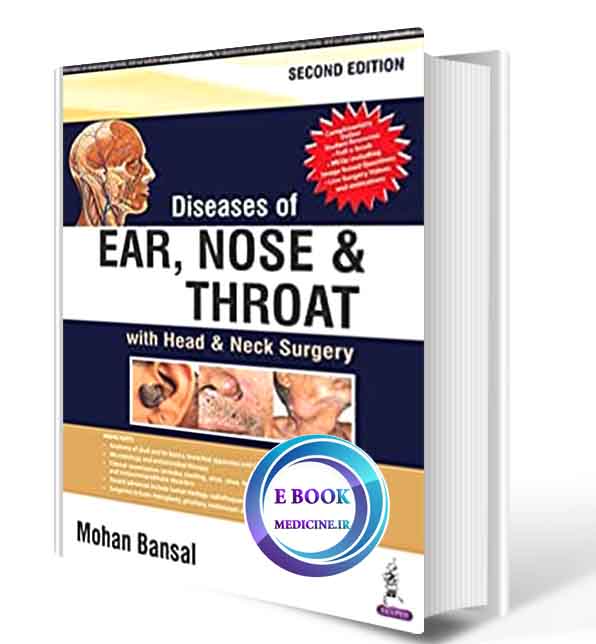 دانلود کتاب Diseases of Ear, Nose and Throat: with Head & Neck Surgery   2018  (ORIGINAL PDF)